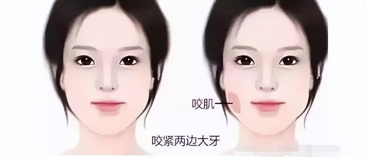 宽脸怎么修饰好看,大宽脸如何变精致窄脸