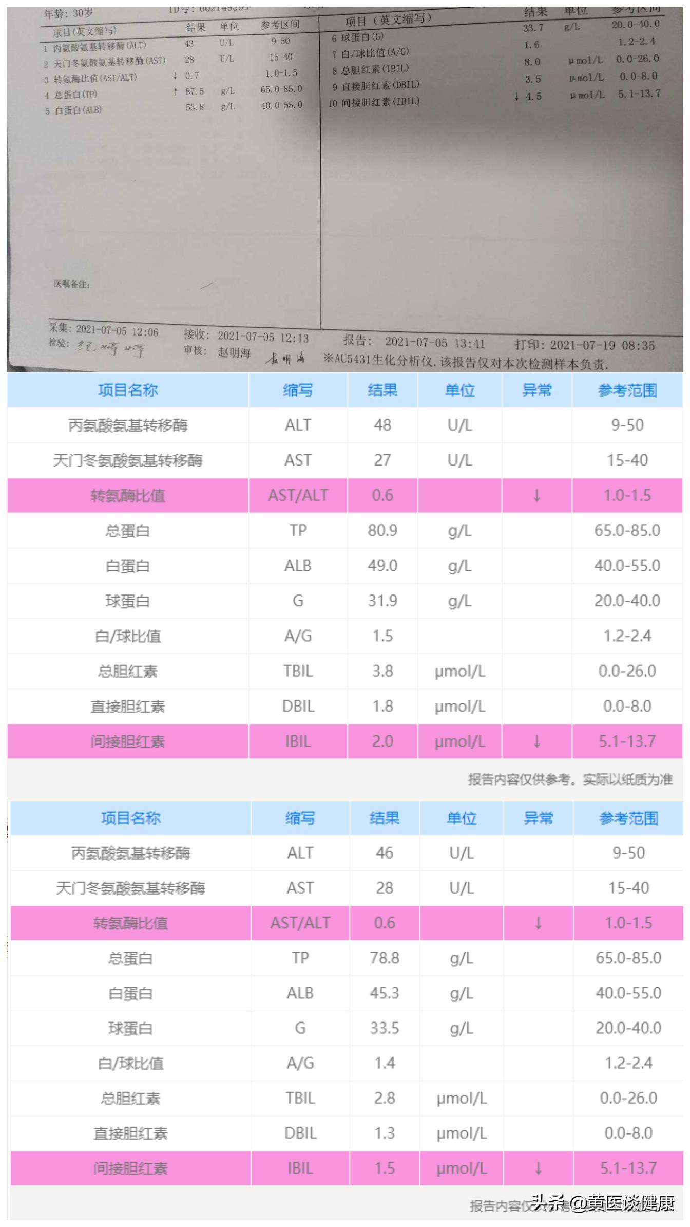 抗病毒三个月肝硬度反而升高,肝抗病毒后抗体升高
