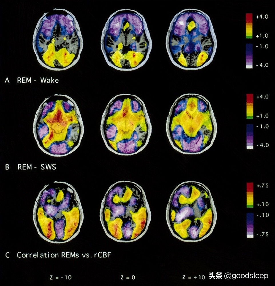 睡觉突然感觉自己清醒就是动不了,睡觉双脚不能动怎么回事
