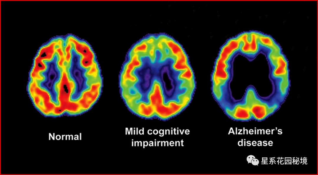 美国学术造假事件,科学数据造假著名事件