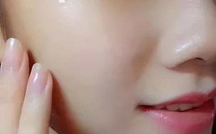 萃雪肤祛痘产品对闭口粉刺有用吗,萃雪肤祛痘精华液