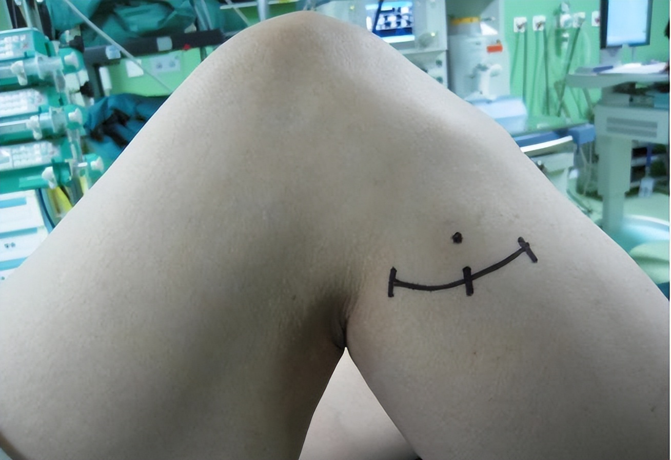 下肢寒凉麻木,糖尿病引起的下肢麻木如何治疗