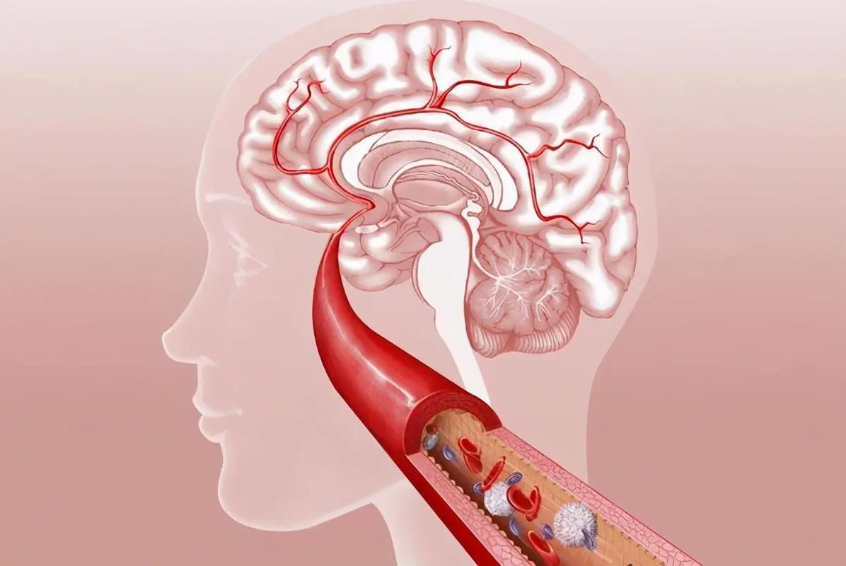 22岁女孩洗完澡突然晕倒后续,22岁女孩洗完澡后昏迷后续