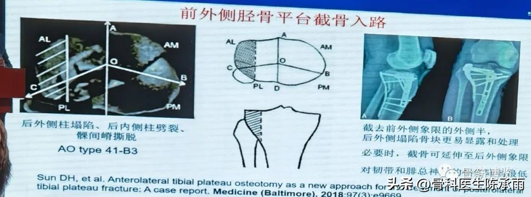 国家卫健委主办的骨创伤专项能力培训项目----下肢损伤学习班