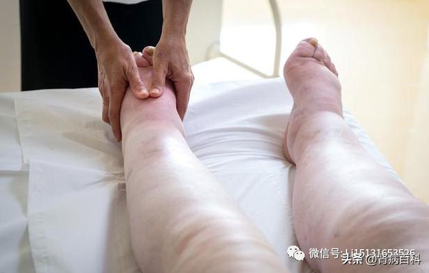 慢性肾脏病早期筛查及防治指南,儿童肾脏病的早期症状