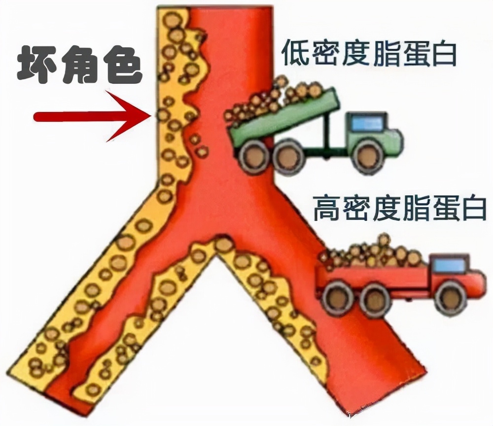 胆固醇血脂高禁止食物一览表,胆固醇升高健康指导