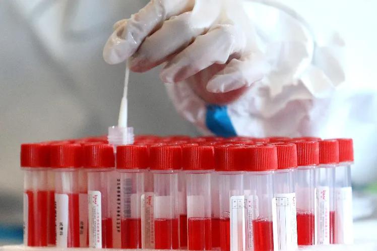 核酸检测阳性和初筛阳性有区别吗,做核酸初筛阳性是真的阳性嘛