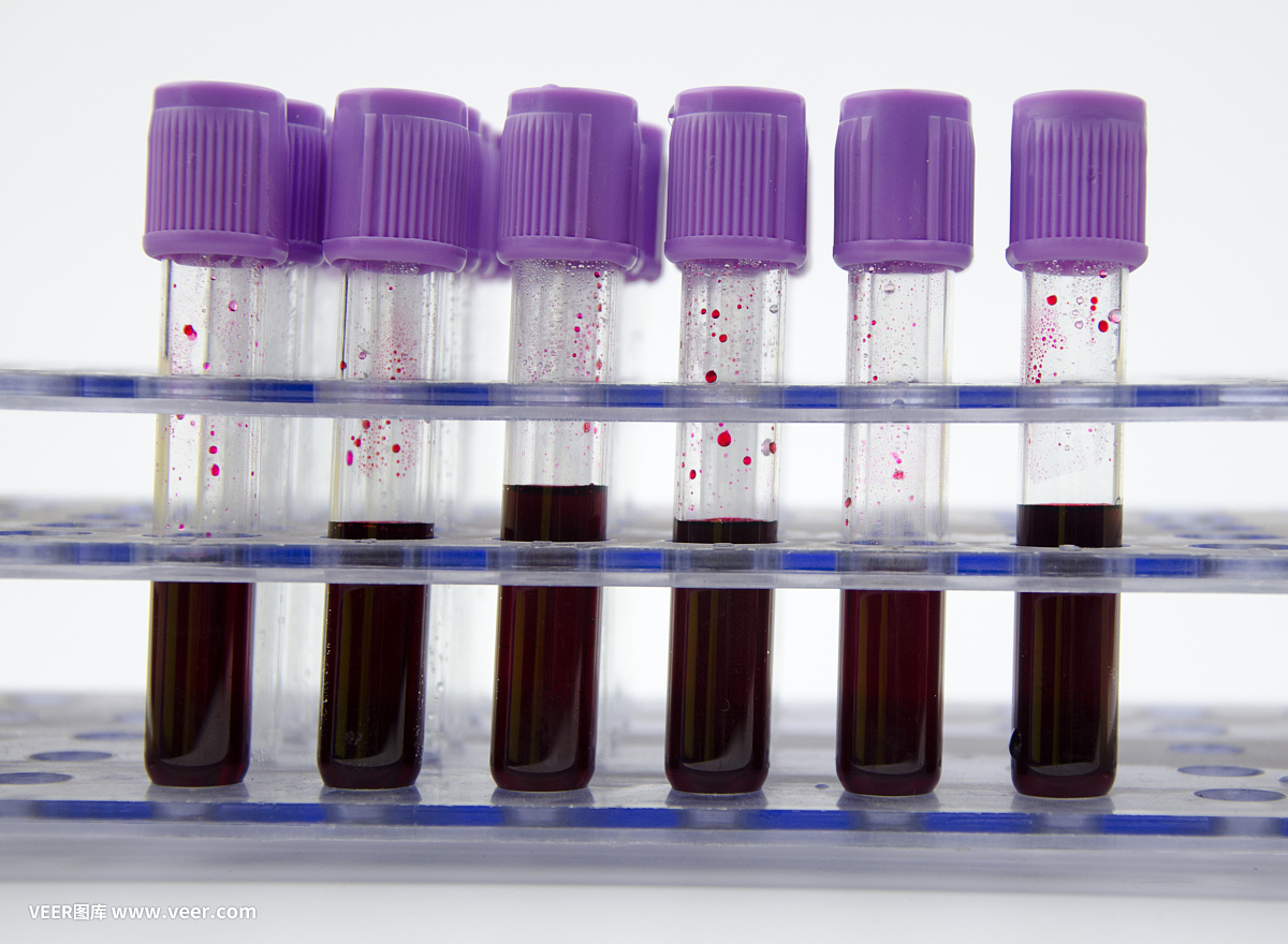 宝鸡发现一例稀有血型,陕西宝鸡18岁女孩罕见的血型