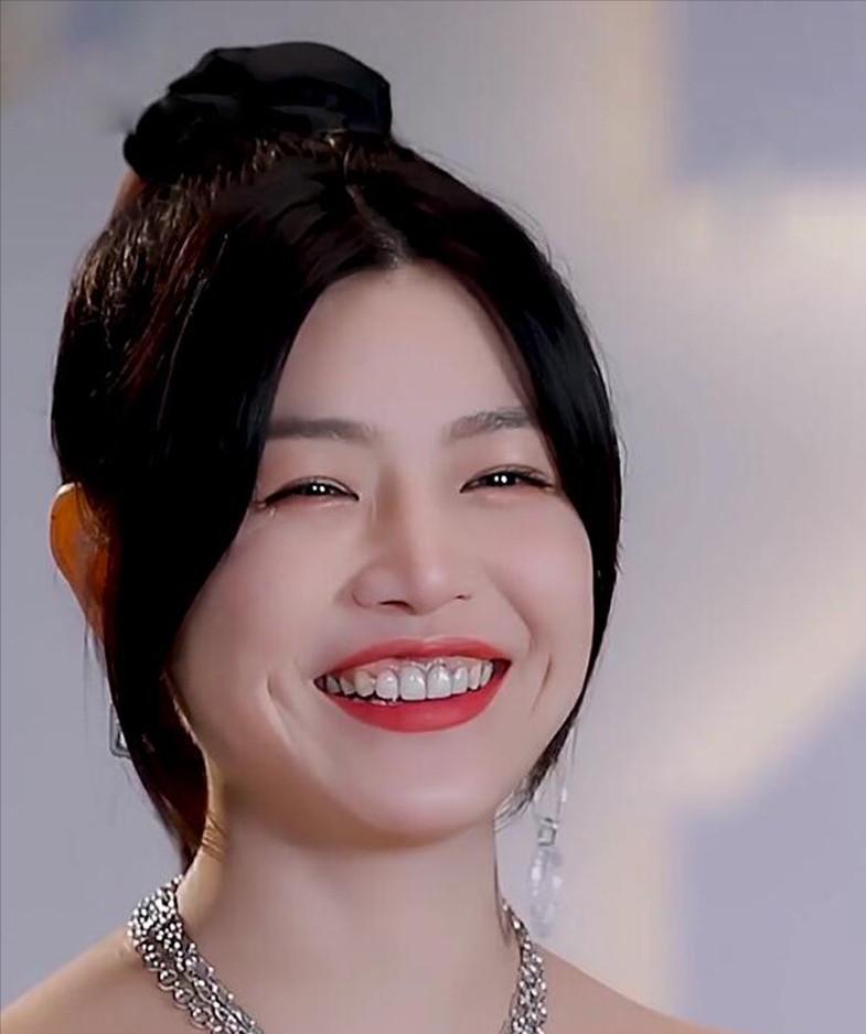 明星做烤瓷牙变凸嘴,明星烤瓷牙凸嘴