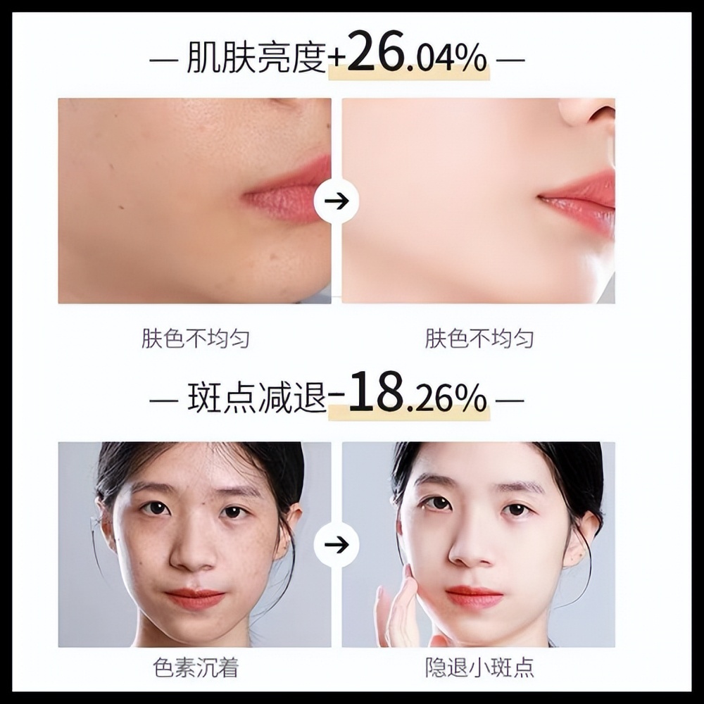 淡斑效果排名第一哪款口碑最好,维生素e哪个牌子好纯天然淡斑