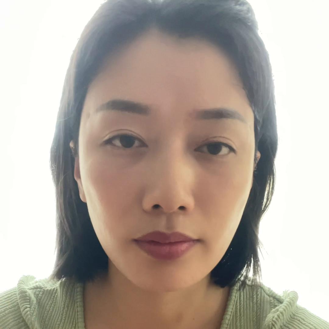 眼周肌肉下垂训练方法,改善眼部肌肉下垂让眼睛变有神