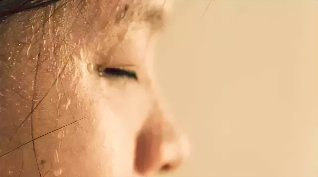 感冒出汗多怎么补充营养,出汗过多需要补充哪些营养