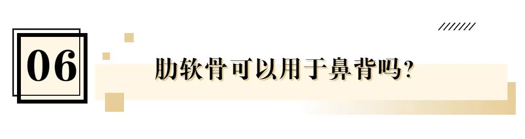 韦敏隆鼻鼻翼缩小,上海韦敏隆鼻案例