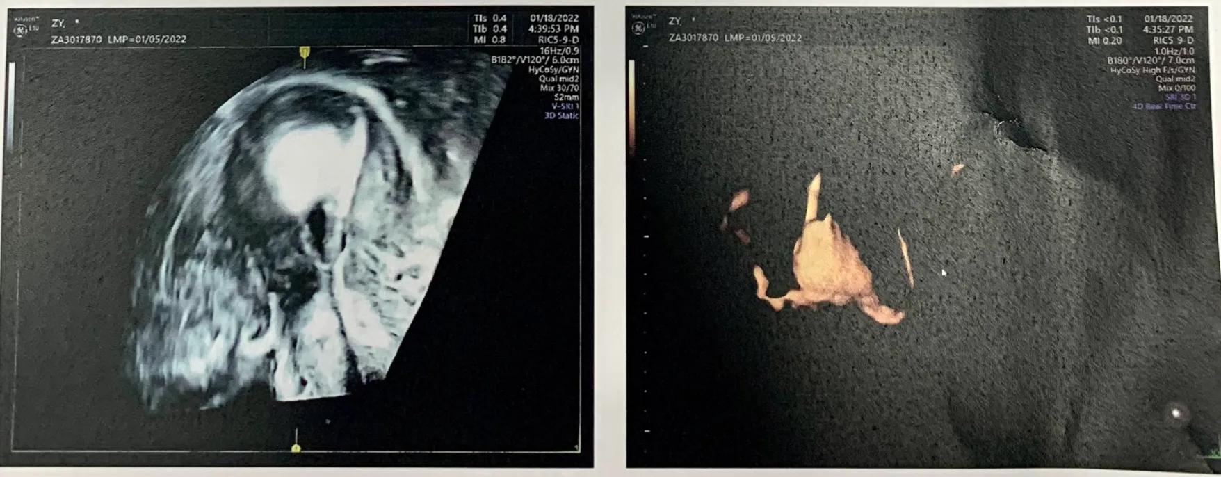 妇科医生讲述真实故事,妇产科手术室里的故事