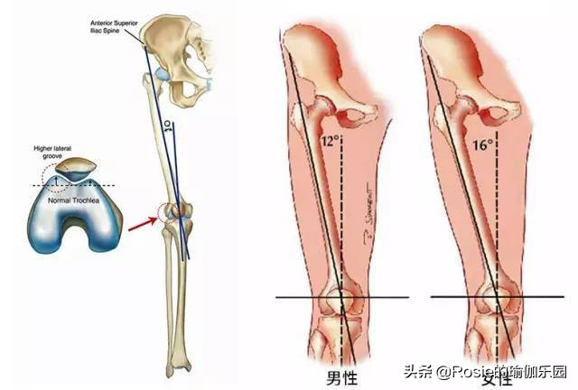 小腿外翻怎么瘦腿变成直腿,如何改善大腿外翻小腿外翻