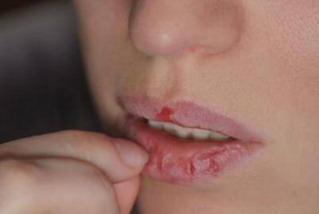 晚上睡觉嘴和嗓子发干是什么原因,晚上睡觉总是感觉嘴干怎么回事