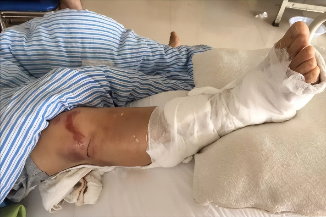 住桥洞研究彩票男子近况,男子痴迷彩票住桥洞中奖