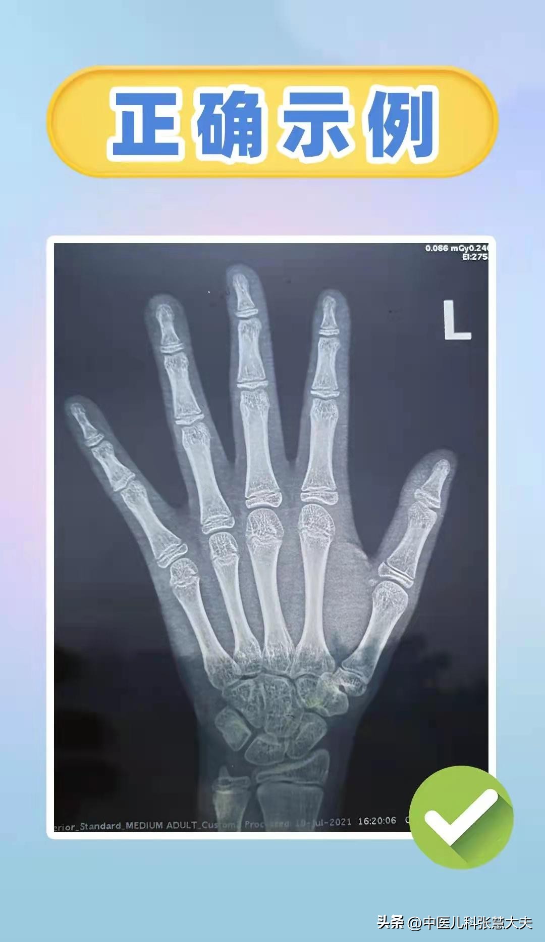 孩子是早成熟好还是晚成熟好,儿童是早长好还是晚长好