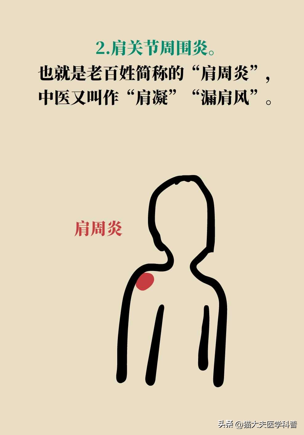 肩膀痛抬胳膊就痛是什么原因,肩膀疼痛做爬墙锻炼