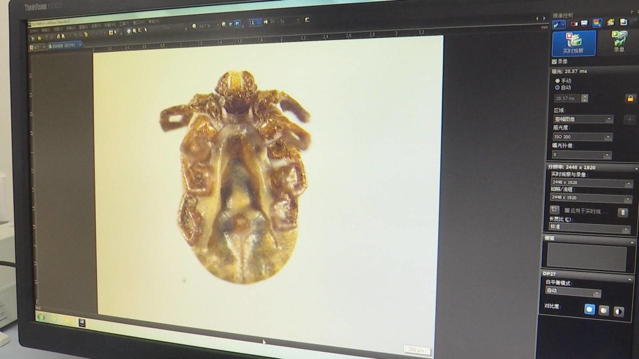 警惕又到蜱虫活跃期,又到了螨虫高发季