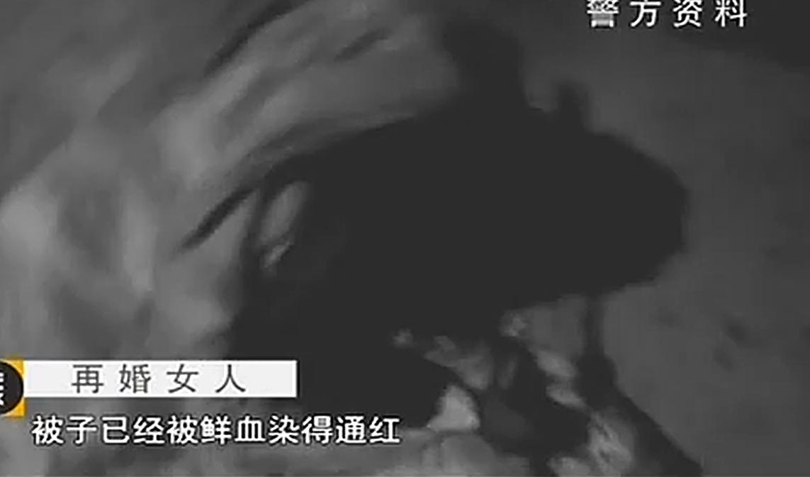 男子杀害前妻后本想*焚自**，结果烧到裆部受不了，跳进水中成功自救