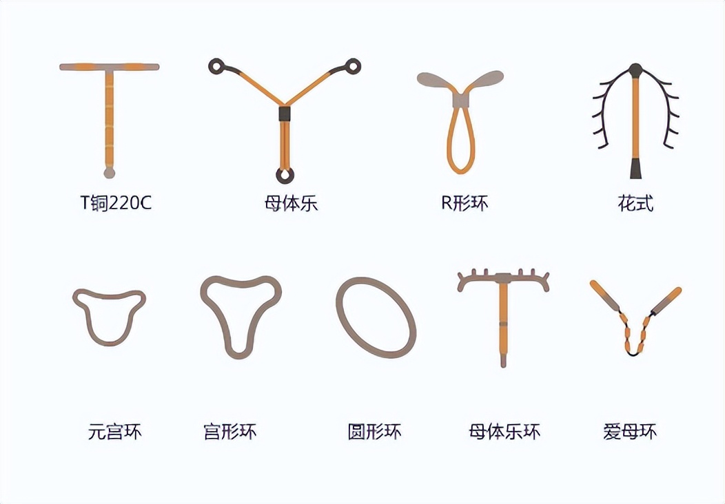 上曼月乐环需要打局部麻药吗,上曼月乐环需要打麻药吗