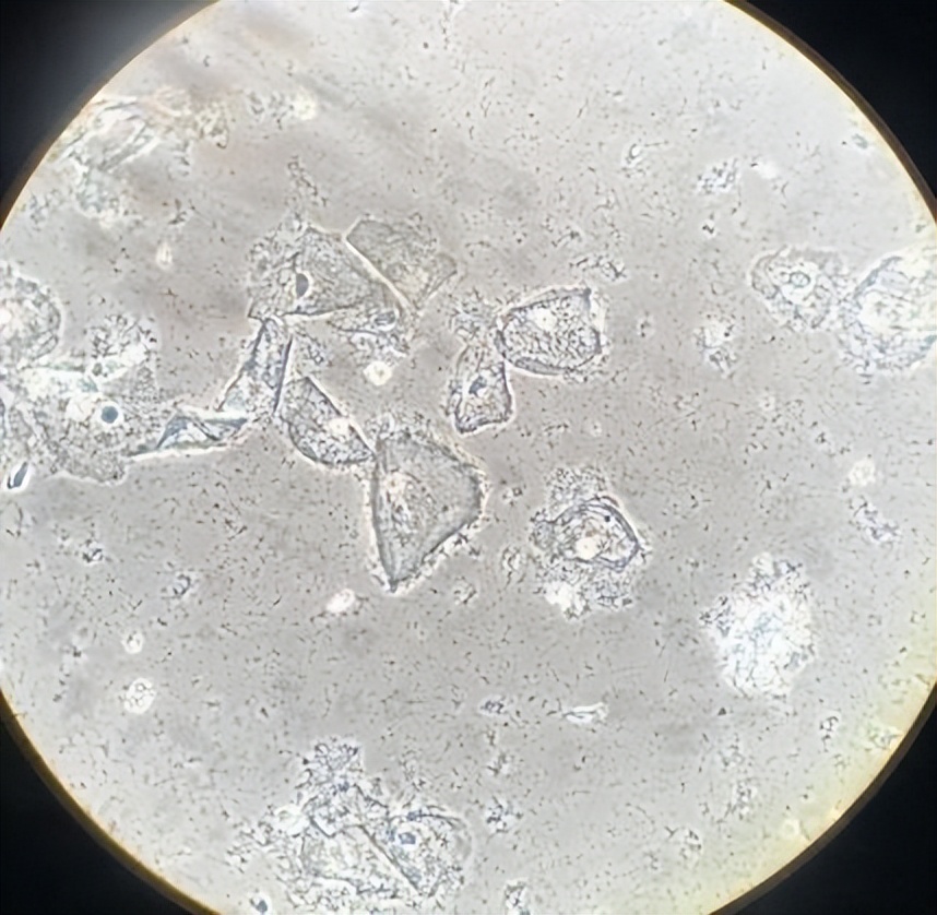 阴道菌群的时代来了！一文了解最新动态