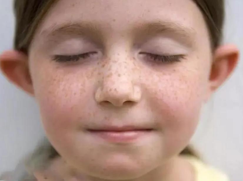 隐私部位的毛发变白，意味着体内有疾病吗？能不能刮掉？