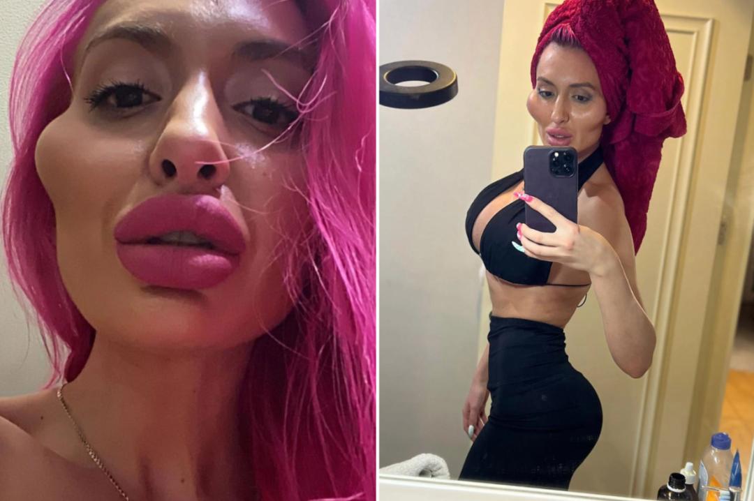 这个动手术打造世界最高颧骨的女人，再次向自己的颧骨下手了