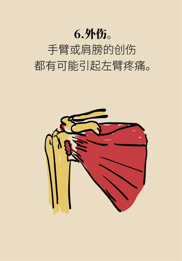 左手臂发麻左胸不舒服是心脏病吗,左手臂疼痛是什么原因和征兆