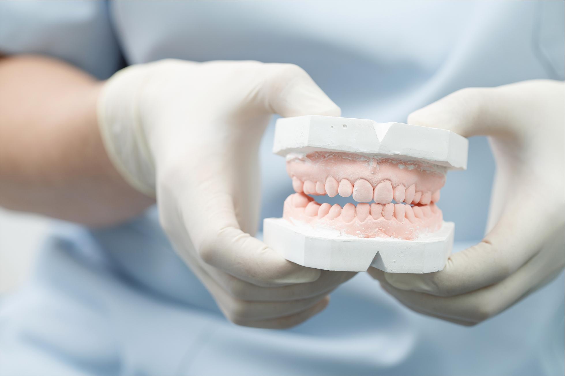 牙齿贴面什么材质经济又耐用,牙齿瓷贴面哪家做的好