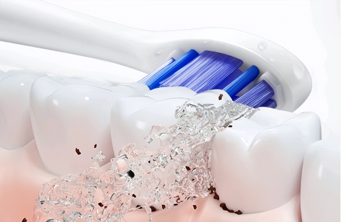 爆款电动牙刷测评：口腔师解读飞利浦欧乐b哪个好