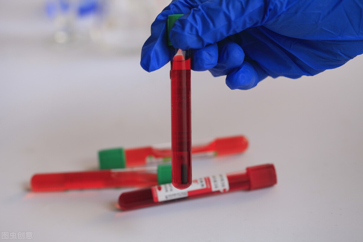 婚前检查都有什么啊,你们做过婚前检查吗