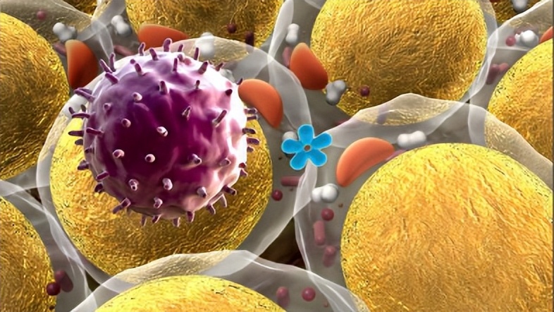 脂肪肉瘤和脂肪瘤摸着区别,脂肪瘤很常见吗