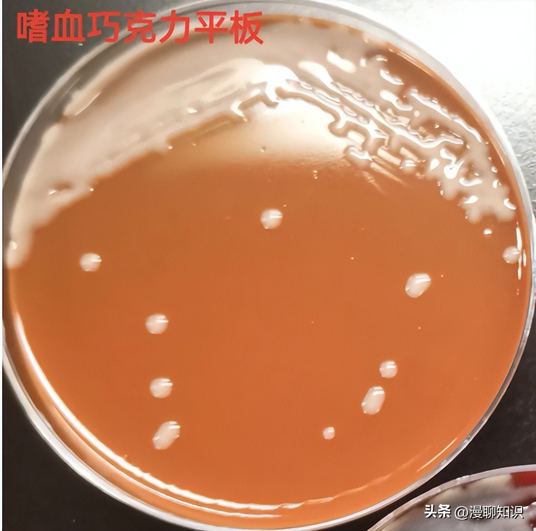 老年人得了肺炎应如何有效医治,肺炎有多严重怎么办