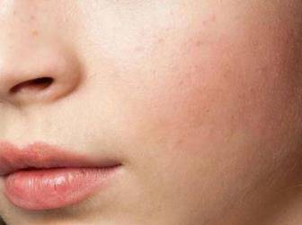 肥皂洗脸伤脸吗,使用肥皂洗脸坏处