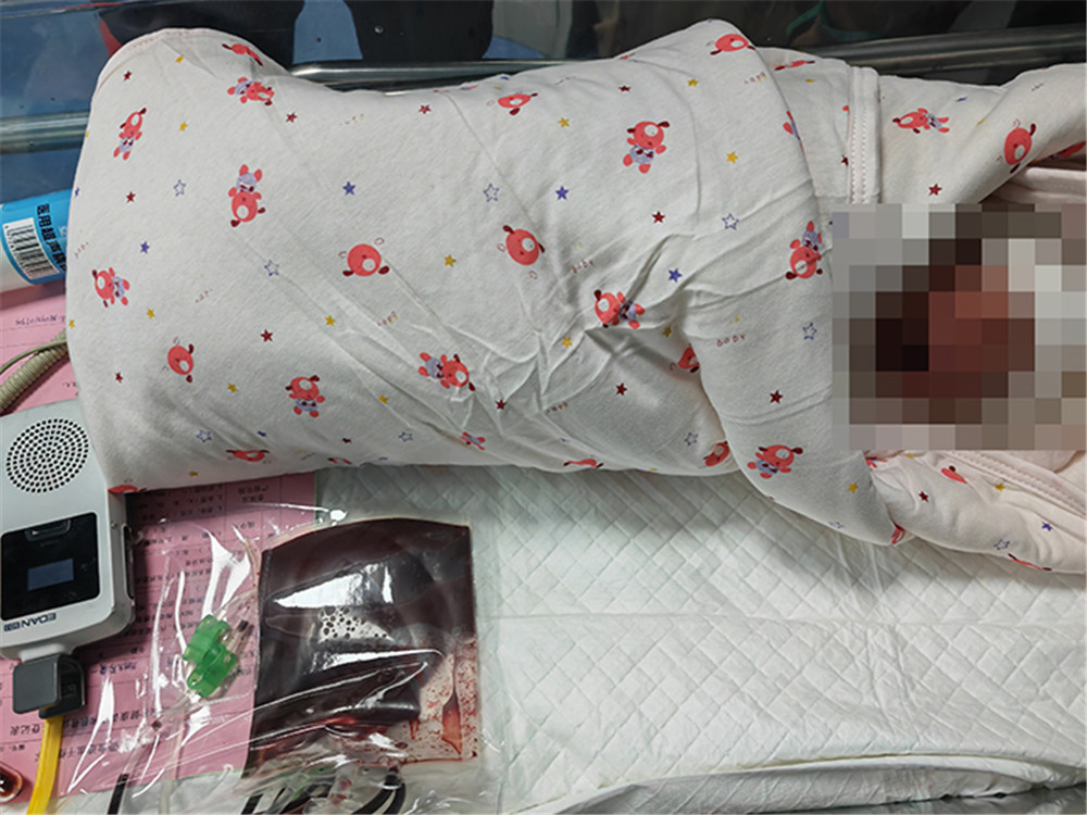 西北首例！“试管”弟弟脐带血救患地中海贫血姐姐