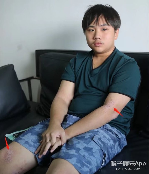 下一站幸福小小彬花絮,下一站幸福小小彬得的病