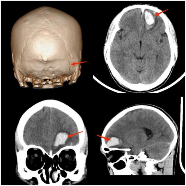 运动损伤知识科普宣传内容,关于足球运动损伤调查问卷