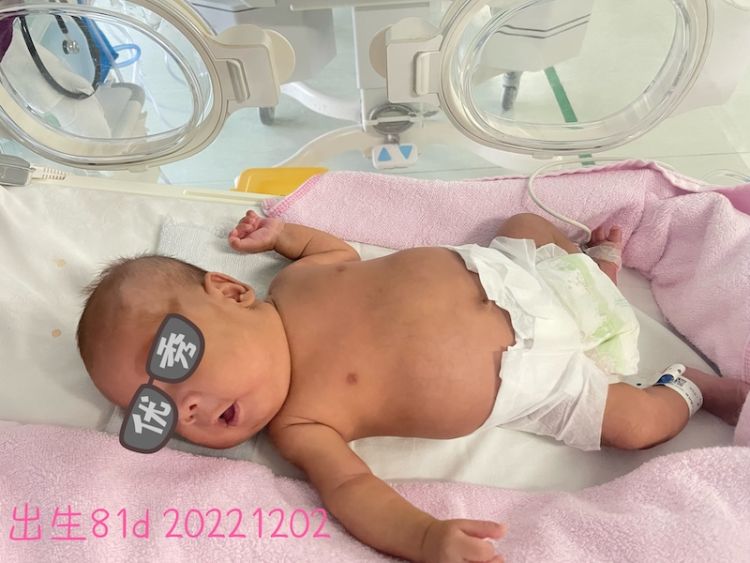 25周的胎宝宝有2斤吗,25周出生的宝宝750克可以存活吗