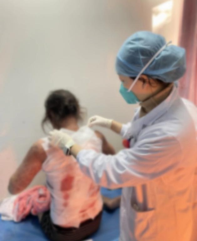 女子突然发烧吓得连吃5种药，引发重症药疹致全身体无完肤