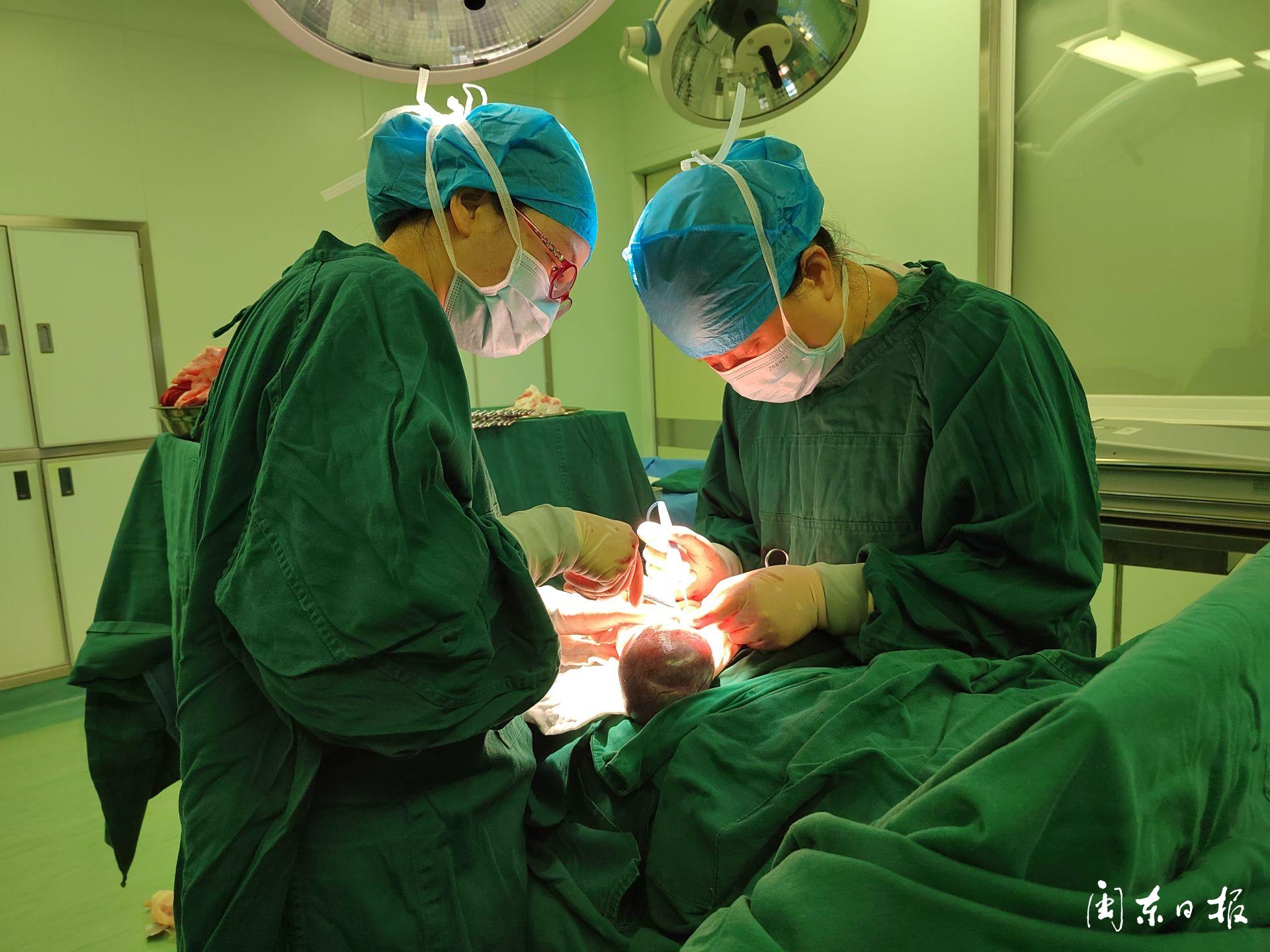 人民医院妇产科切除巨大子宫肌瘤,剖腹取大肌瘤